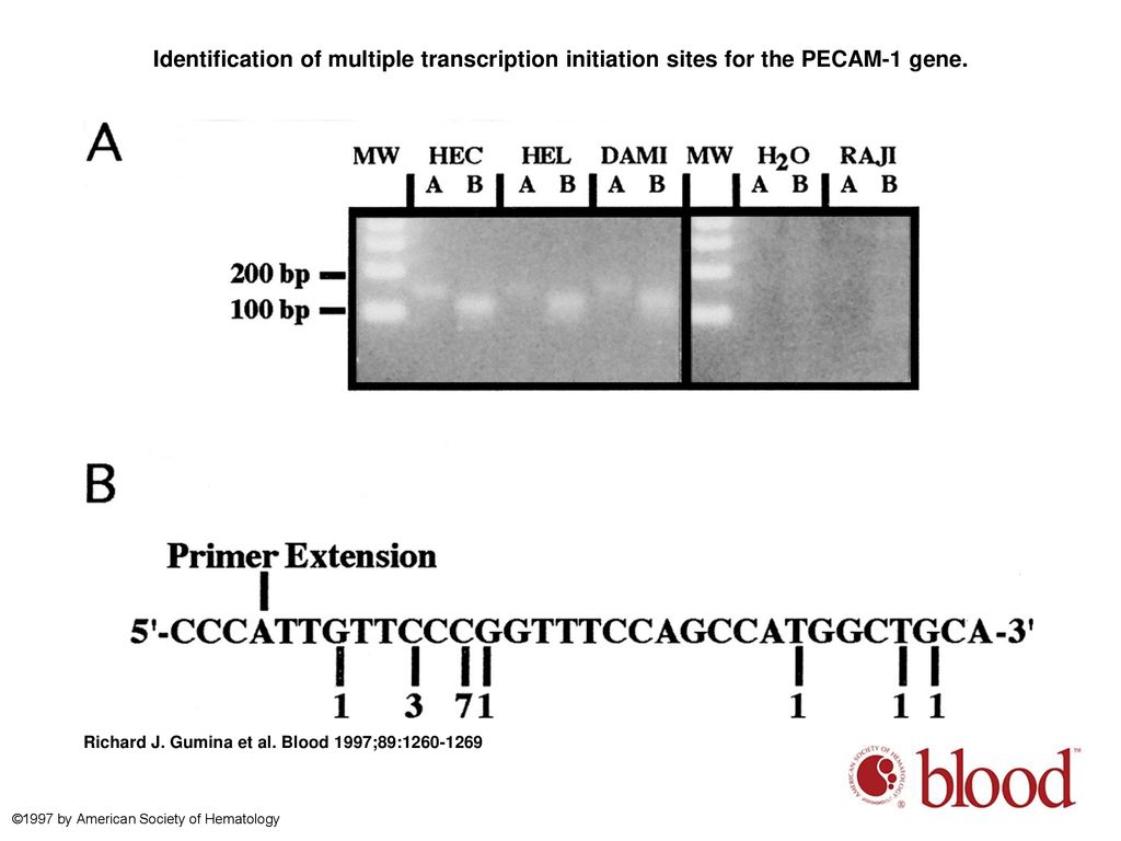 Identification of multiple transcription initiation sites for the PECAM-1 gene.