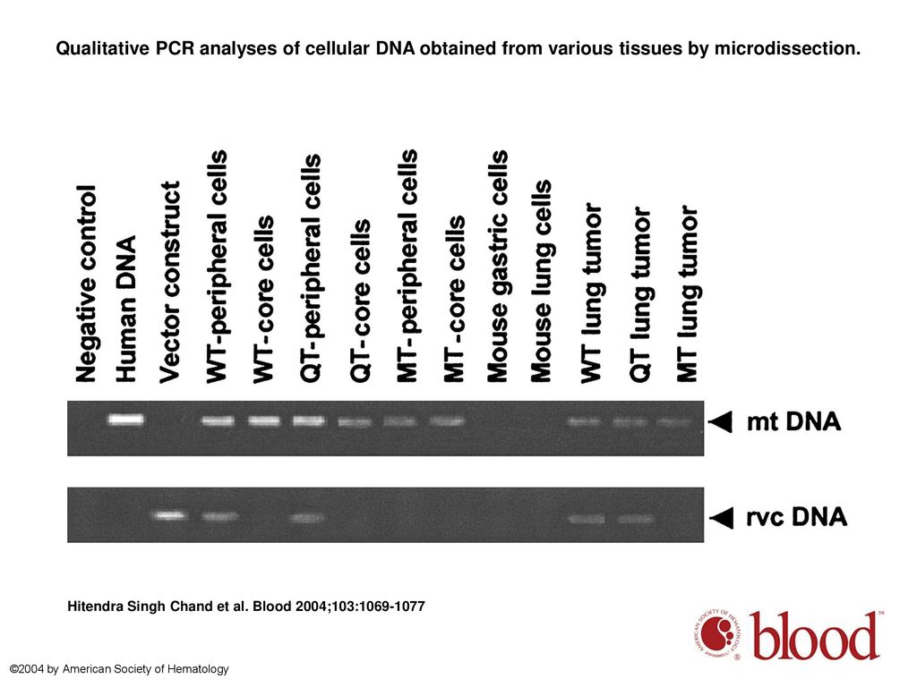 Qualitative PCR analyses of cellular DNA obtained from various tissues by microdissection.