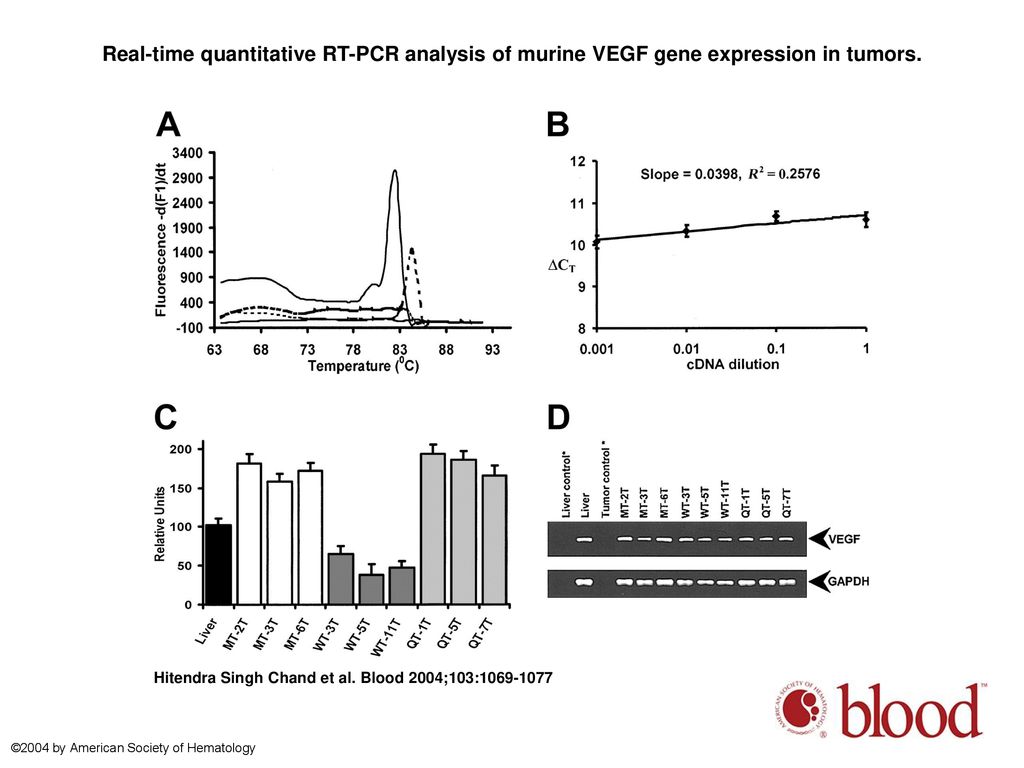 Real-time quantitative RT-PCR analysis of murine VEGF gene expression in tumors.