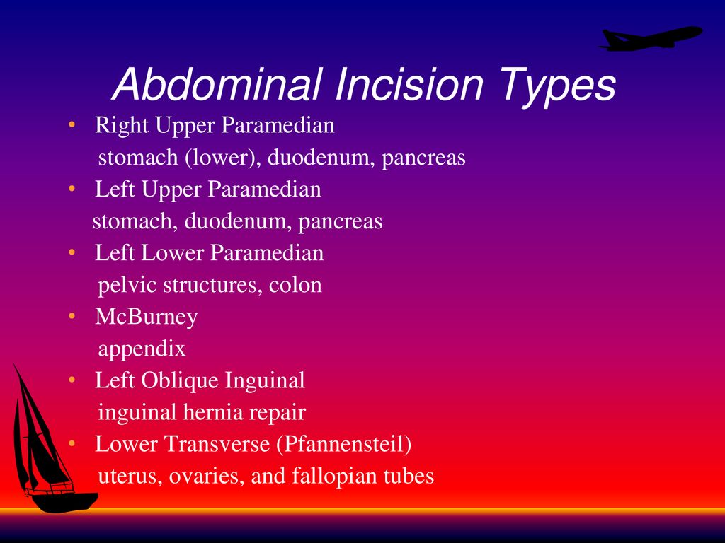 Reviewing The Chart & Abdominal Incisions - ppt download