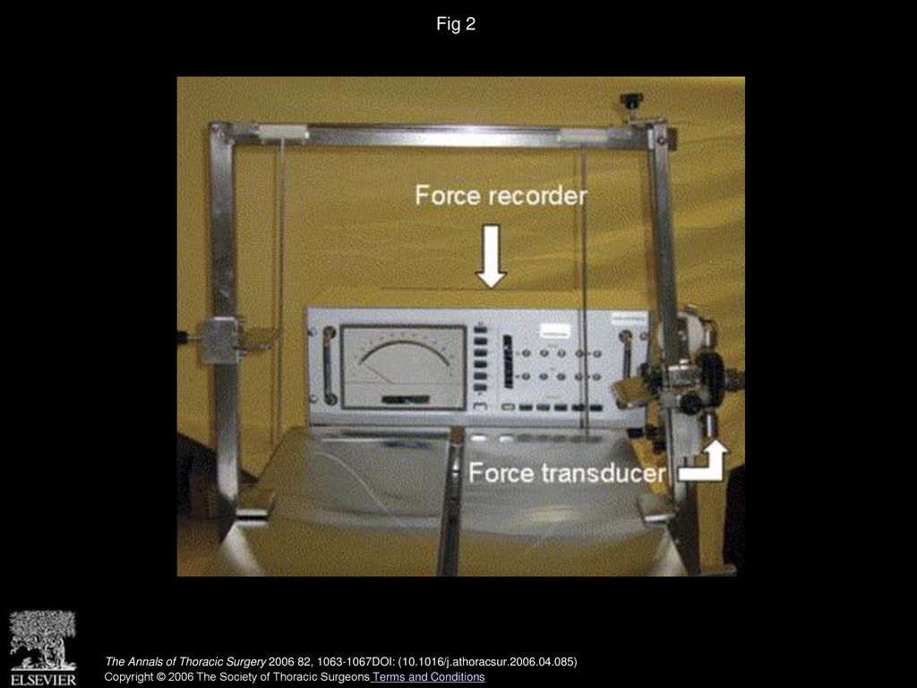 Fig 2 A custom-made device for investigating sternal stability connected to a force transducer (angled arrow) and a force recorder (straight arrow).