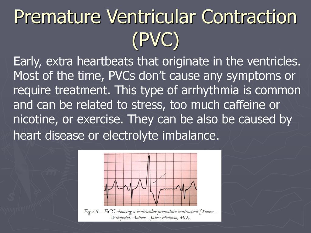 Heart conduction system ppt download