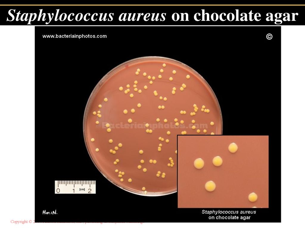 Staphylococcus aureus степени. Стафилококк золотистый Staphylococcus aureus. Стафилококки (s. aureus),. Стафилококк ауреус 10.