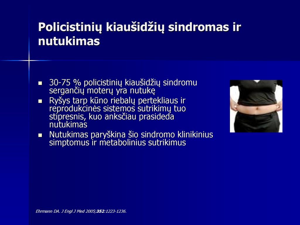 Kmuk Endokrinologijos Klinika Ppt Download