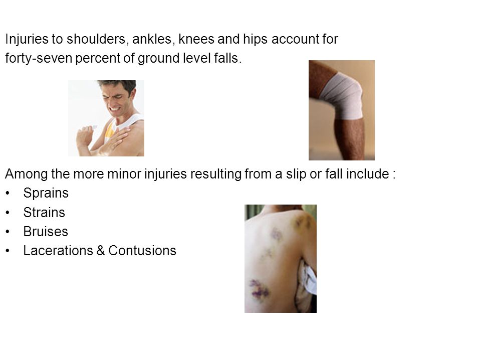 Injuries to shoulders, ankles, knees and hips account for