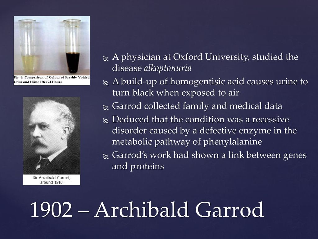 A physician at Oxford University, studied the disease alkoptonuria