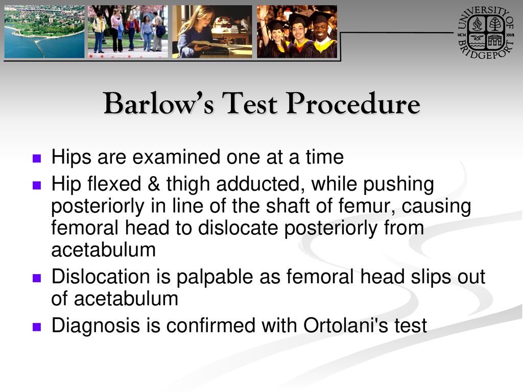 Barlow’s Test Procedure