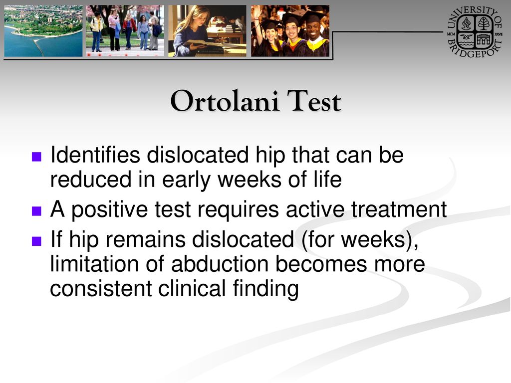 Ortolani Test Identifies dislocated hip that can be reduced in early weeks of life. A positive test requires active treatment.
