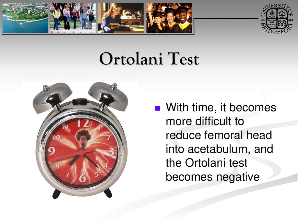 Ortolani Test With time, it becomes more difficult to reduce femoral head into acetabulum, and the Ortolani test becomes negative.