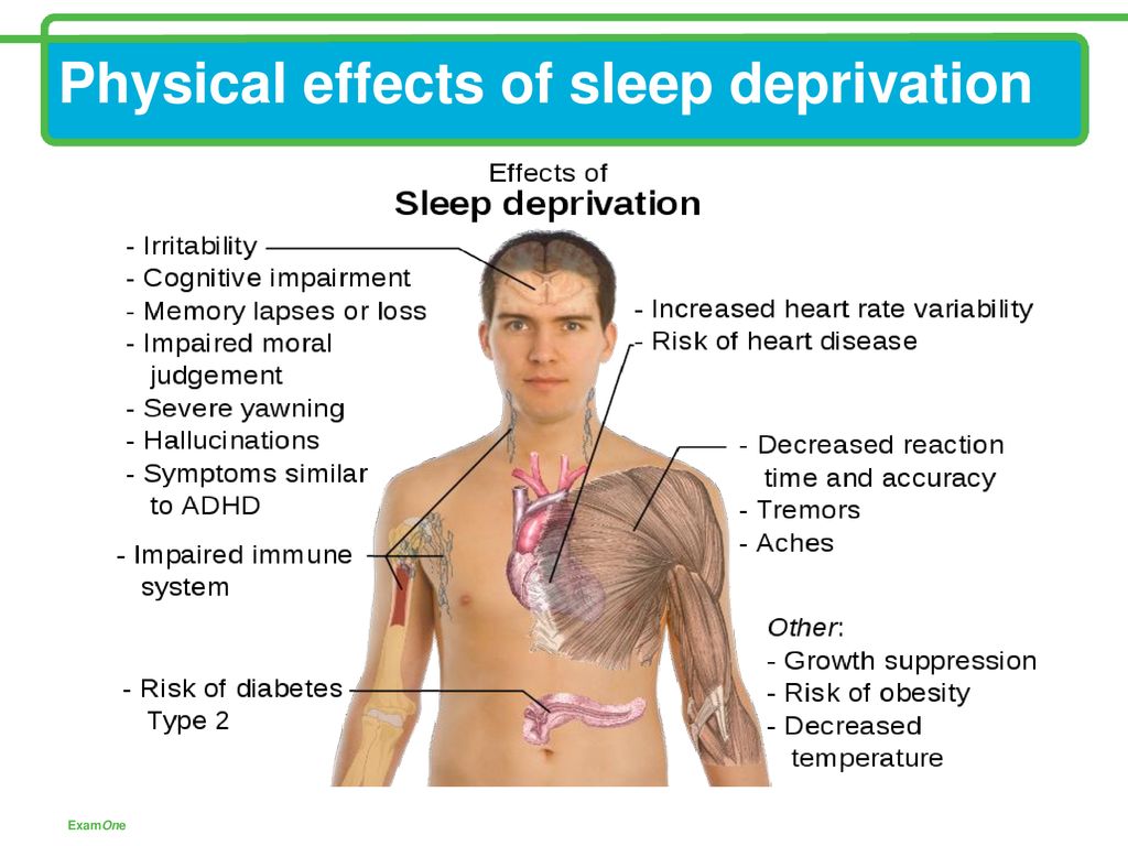 Of sleep effects physical of lack What Are