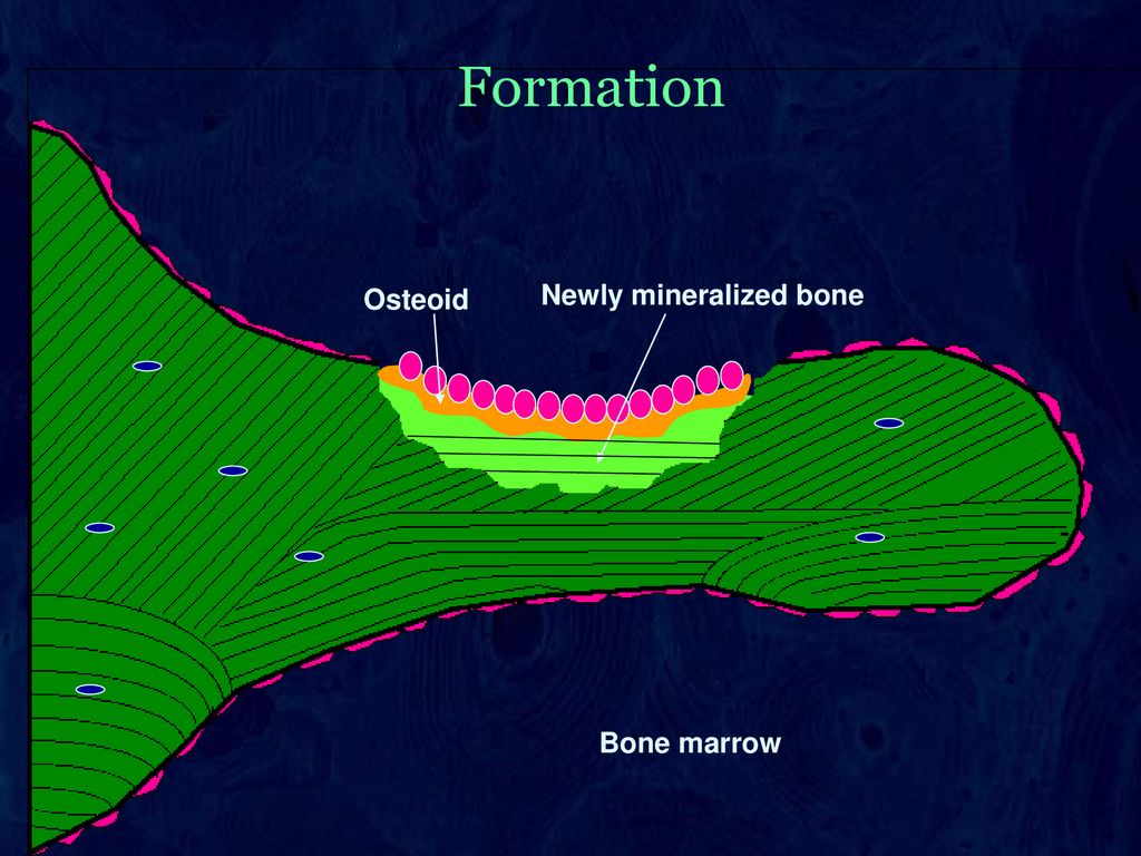 Formation Osteoid Newly mineralized bone Bone marrow