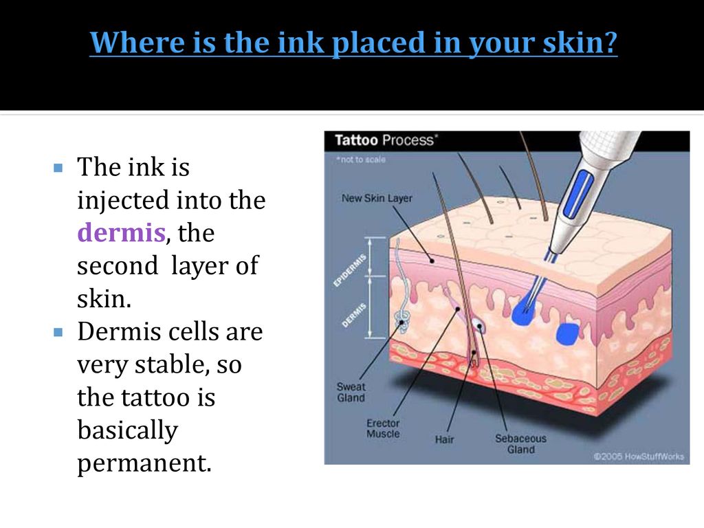 Where is the ink placed in your skin