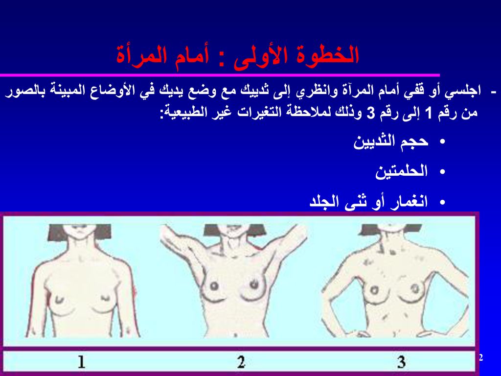 سرطان الثدي breast cancer ppt download