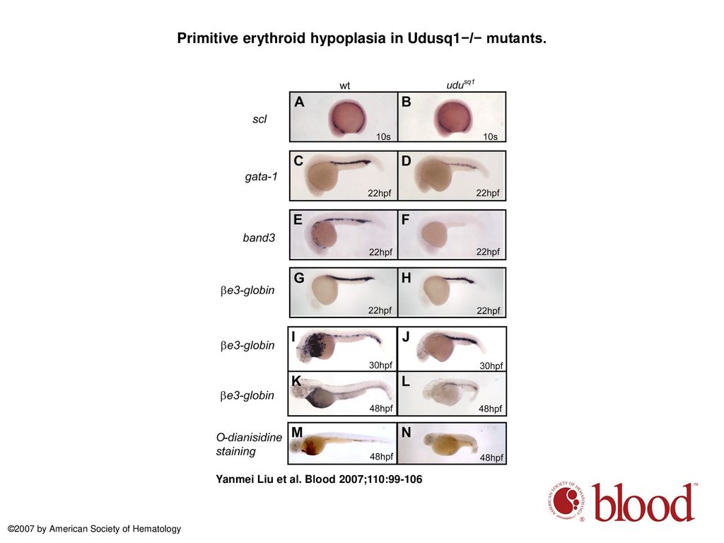 Primitive erythroid hypoplasia in Udusq1−/− mutants.