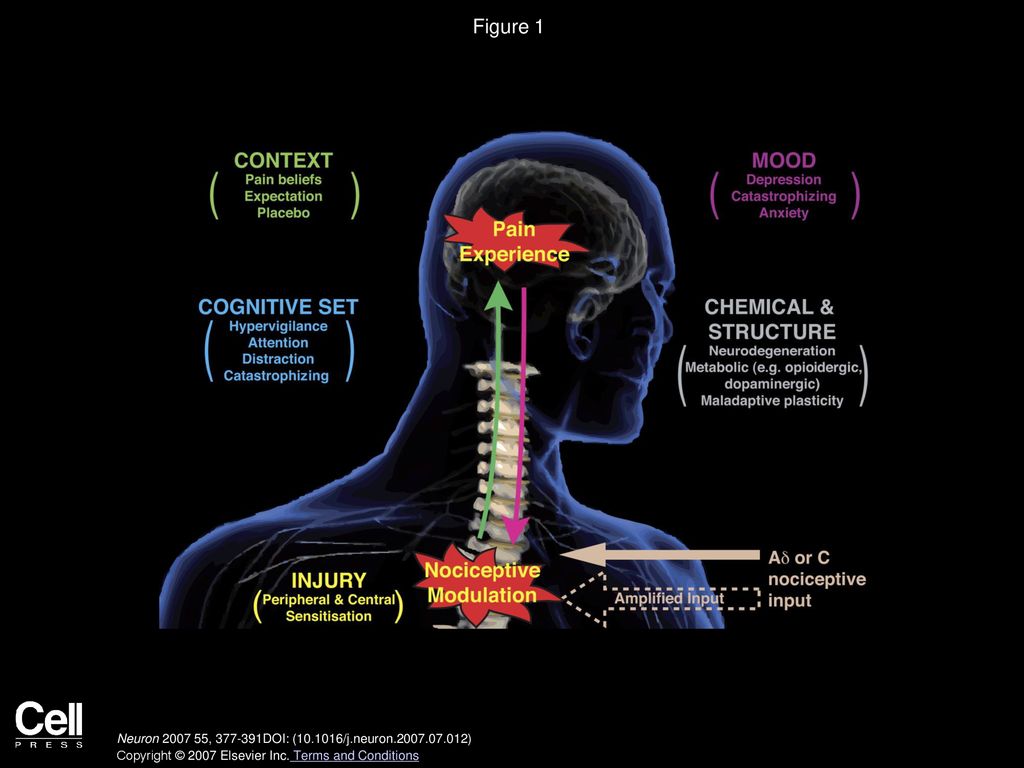 The Cerebral Signature for Pain Perception and Its Modulation Biology Diagrams
