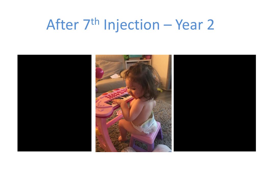 After 7th Injection – Year 2