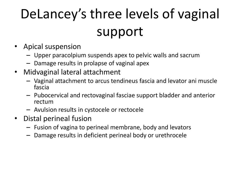 Delancey's three levels of pelvic support – Dutch lables