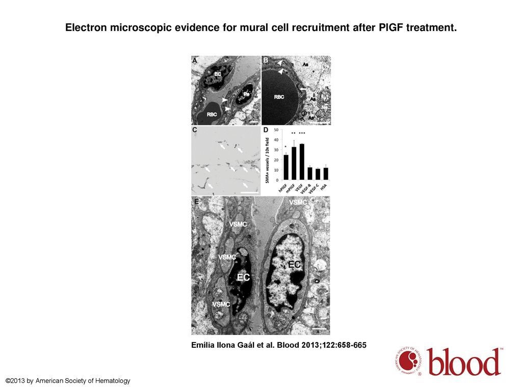 Electron microscopic evidence for mural cell recruitment after PlGF treatment.