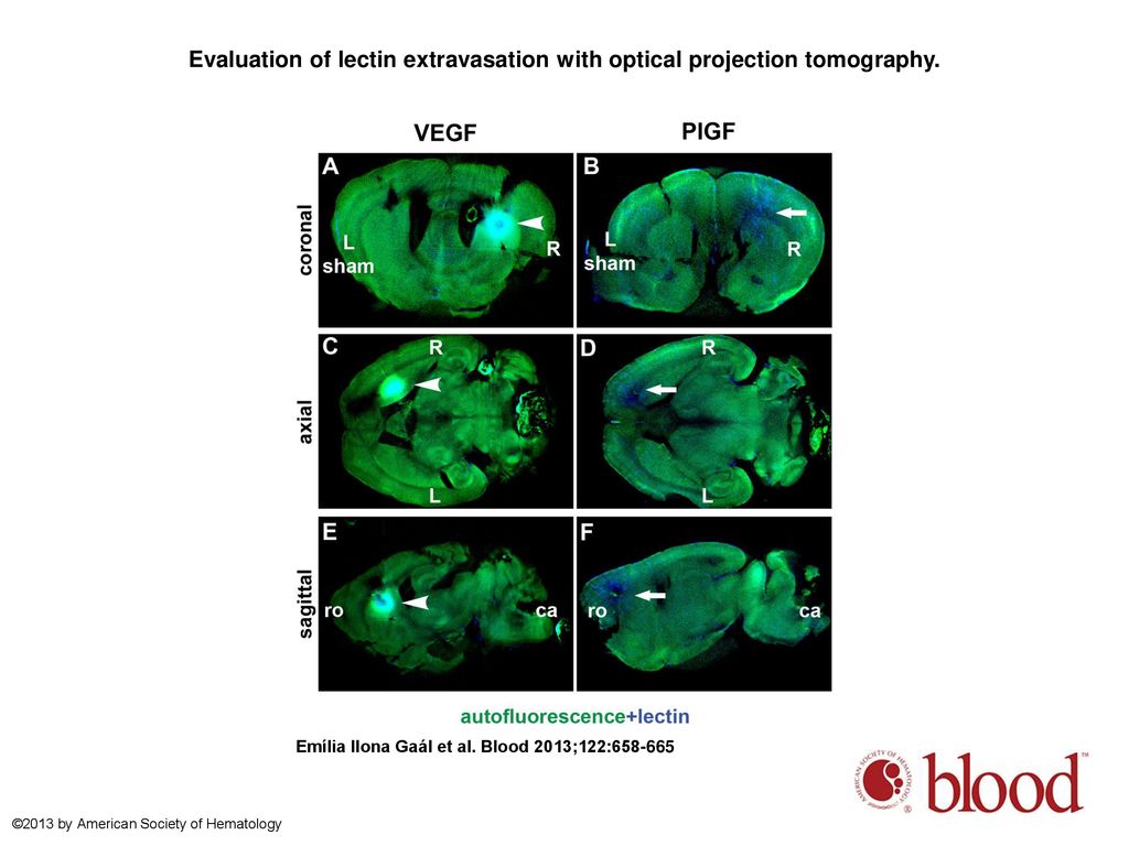 Evaluation of lectin extravasation with optical projection tomography.