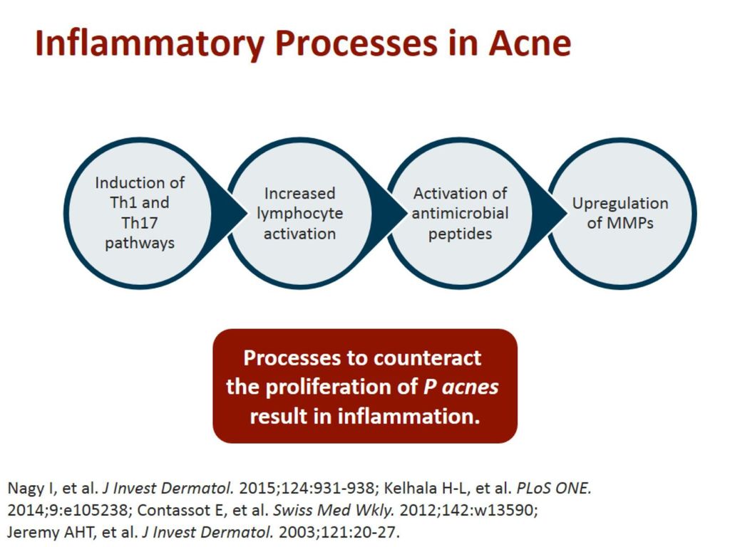 Inflammatory Processes in Acne