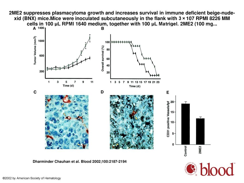 2ME2 suppresses plasmacytoma growth and increases survival in immune deficient beige-nude-xid (BNX) mice.Mice were inoculated subcutaneously in the flank with 3 × 107 RPMI 8226 MM cells in 100 μL RPMI 1640 medium, together with 100 μL Matrigel. 2ME2 (100 mg...