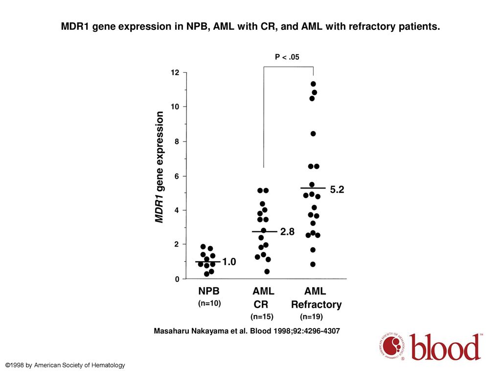 MDR1 gene expression in NPB, AML with CR, and AML with refractory patients.