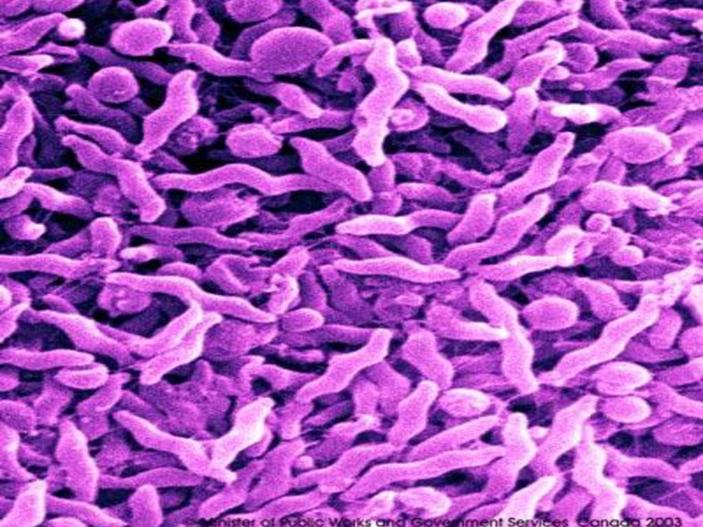 Campylobacter Jejuni Campylobacter Fetus Ppt Download