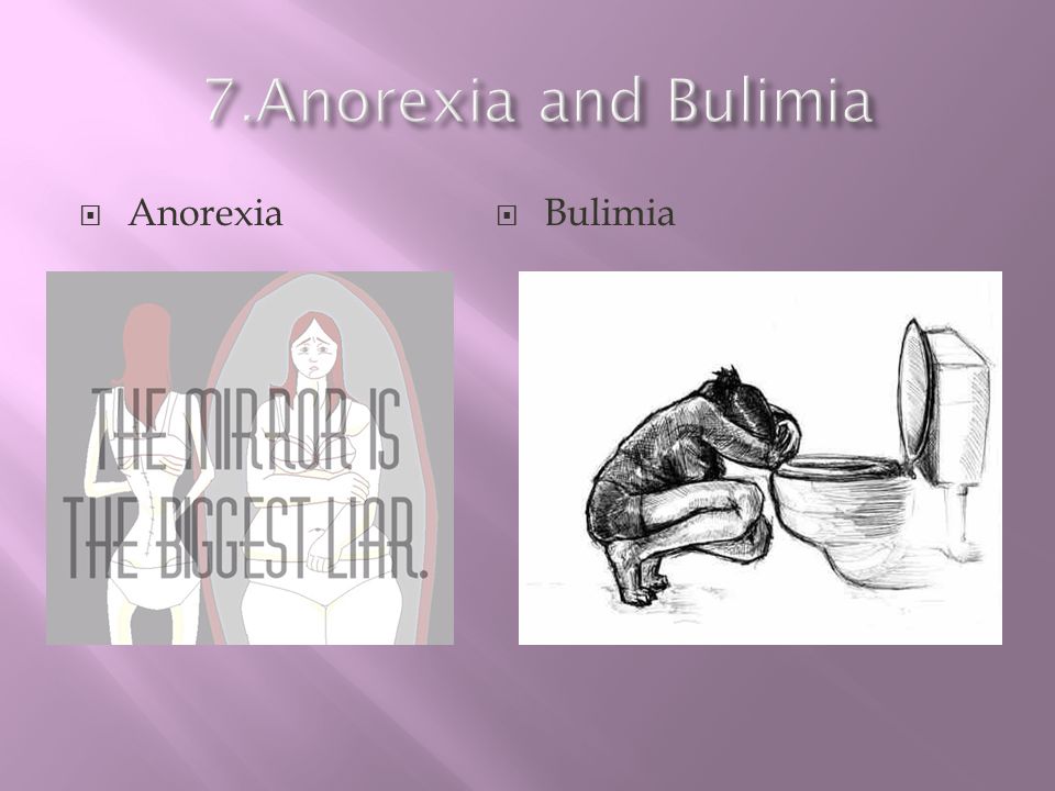 7.Anorexia and Bulimia Anorexia Bulimia