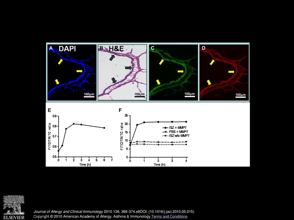 Fluorescence ISZ demonstrates airway epithelial MMP-7 activity