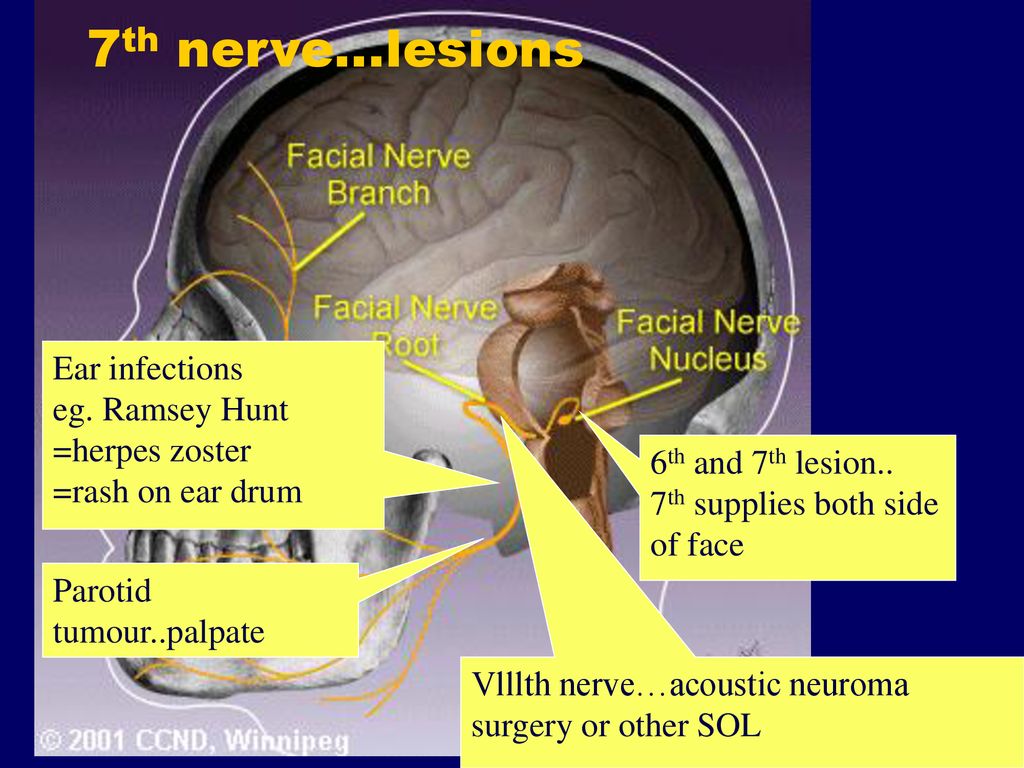 Neuro-ophthalmology: part 3, crainial nerves david. - ppt download
