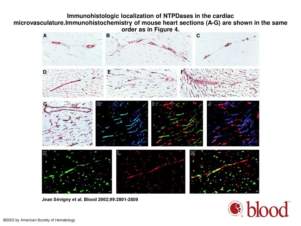 Immunohistologic localization of NTPDases in the cardiac microvasculature.Immunohistochemistry of mouse heart sections (A-G) are shown in the same order as in Figure 4.