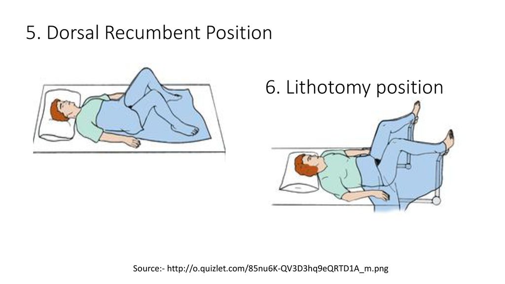 What is the Dorsal Recumbent Position? (2023)