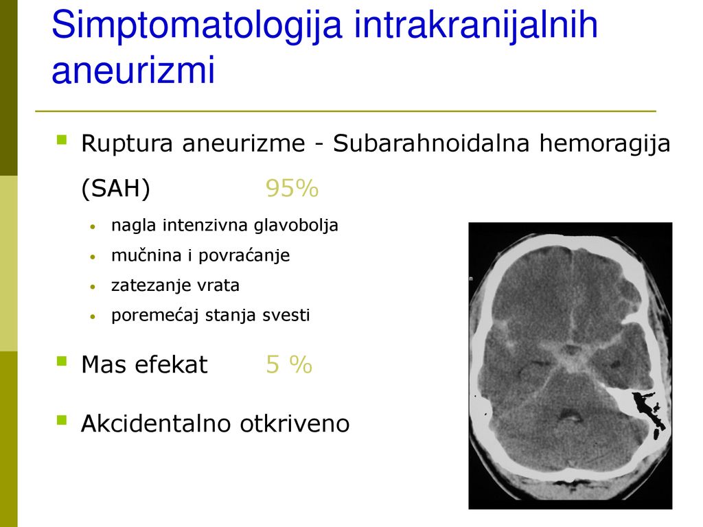 Simptomi koronavirusa glavobolja