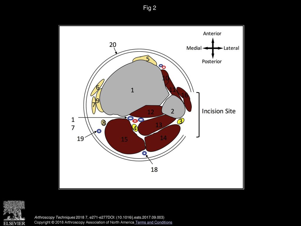 Surgical Management of Proximal Tibiofibular Joint Instability Using an  Adjustable Loop, Cortical Fixation Device William J. McNamara, M.D., Andrew  P. - ppt download
