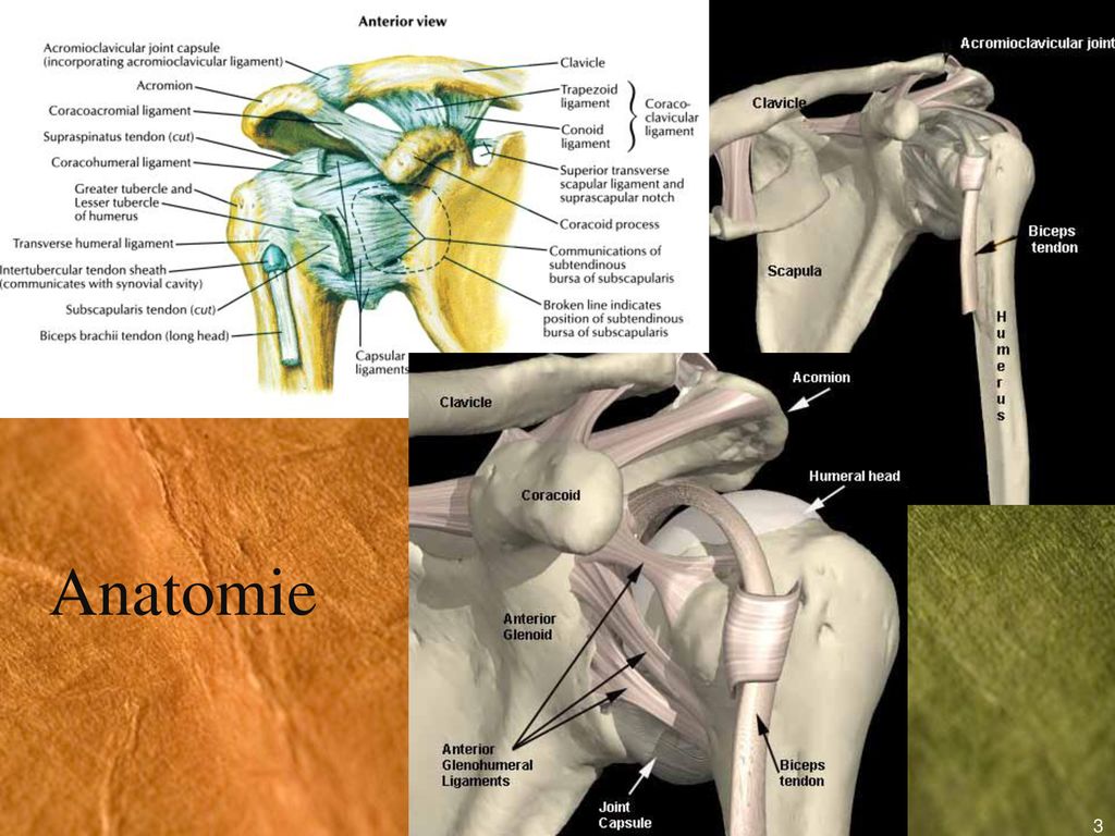 deteriorarea ligamentelor articulației acromioclaviculare