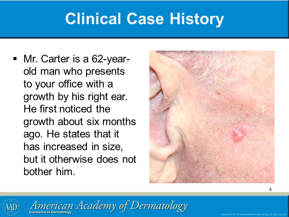Medical Student Core Curriculum in Dermatology - ppt download