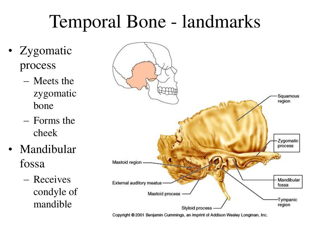 The bones form. Височная кость человека. Височная кость анатомия человека. Височная кость вид снаружи. Чешуйчатая часть височной кости.