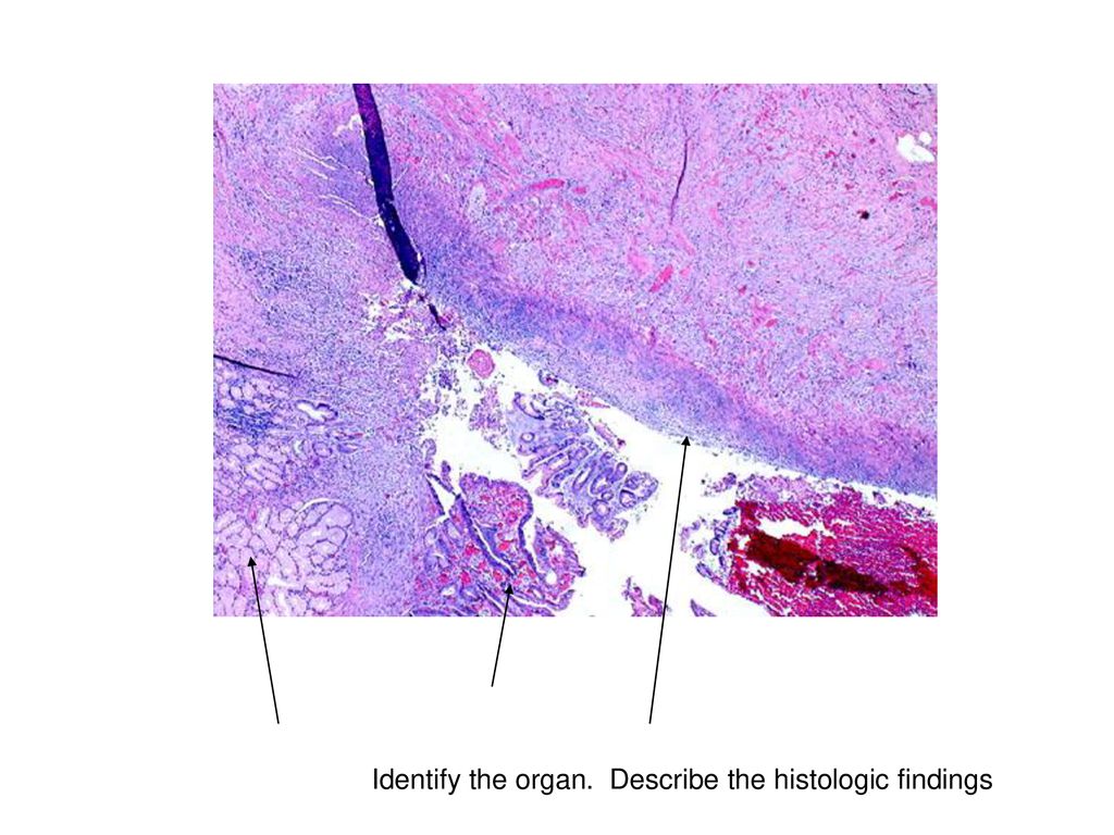 old man presents with epigastric pain Biology Diagrams
