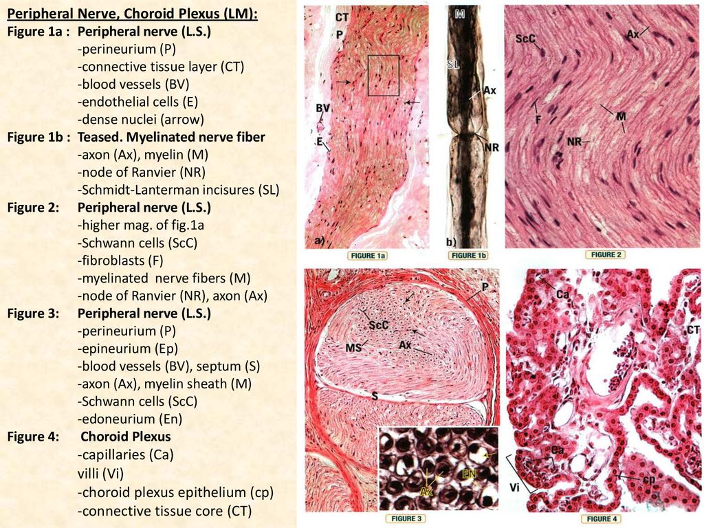 teased myelinated nerve fiber slide