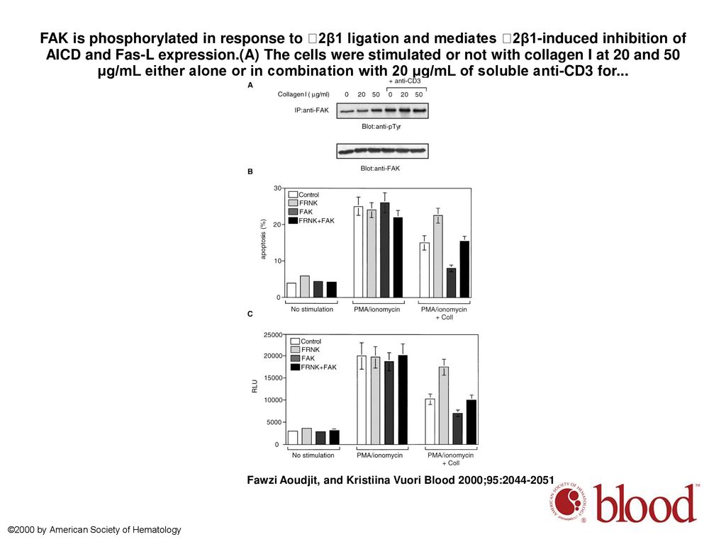 FAK is phosphorylated in response to 2β1 ligation and mediates 2β1-induced inhibition of AICD and Fas-L expression.(A) The cells were stimulated or not with collagen I at 20 and 50 μg/mL either alone or in combination with 20 μg/mL of soluble anti-CD3 for...