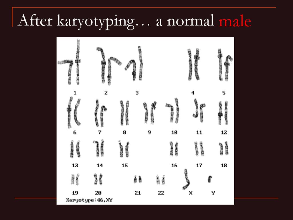 After karyotyping… a normal