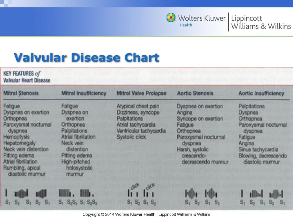 Valvular Heart Disease Chart