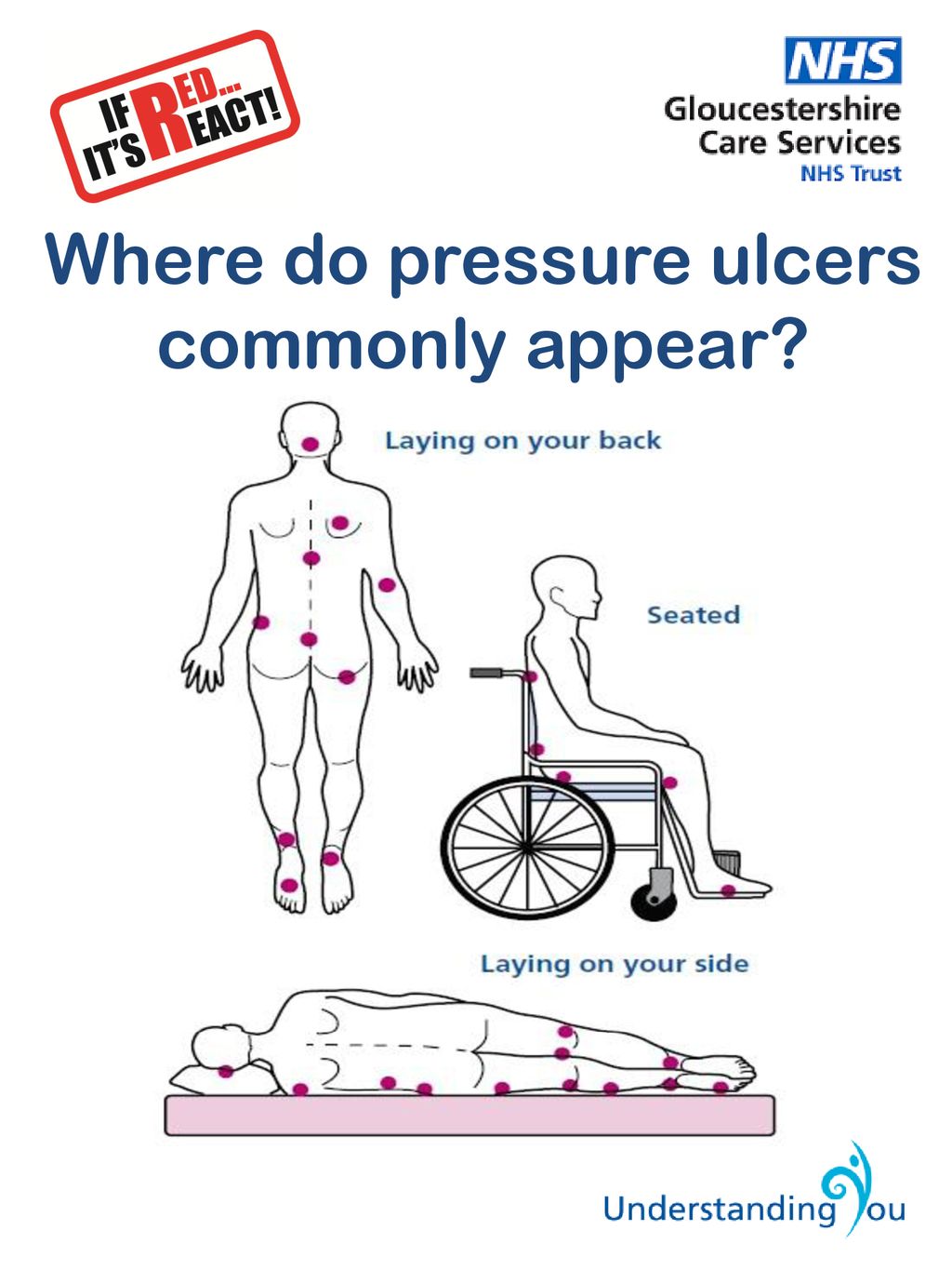 Pressure Ulcers Are You, Or Someone You Care For, At Risk? - Ppt Download