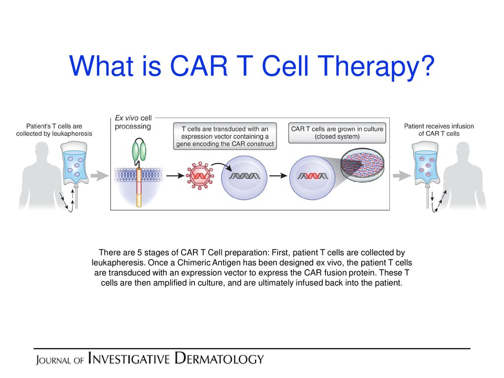 car t cell mesothelioma