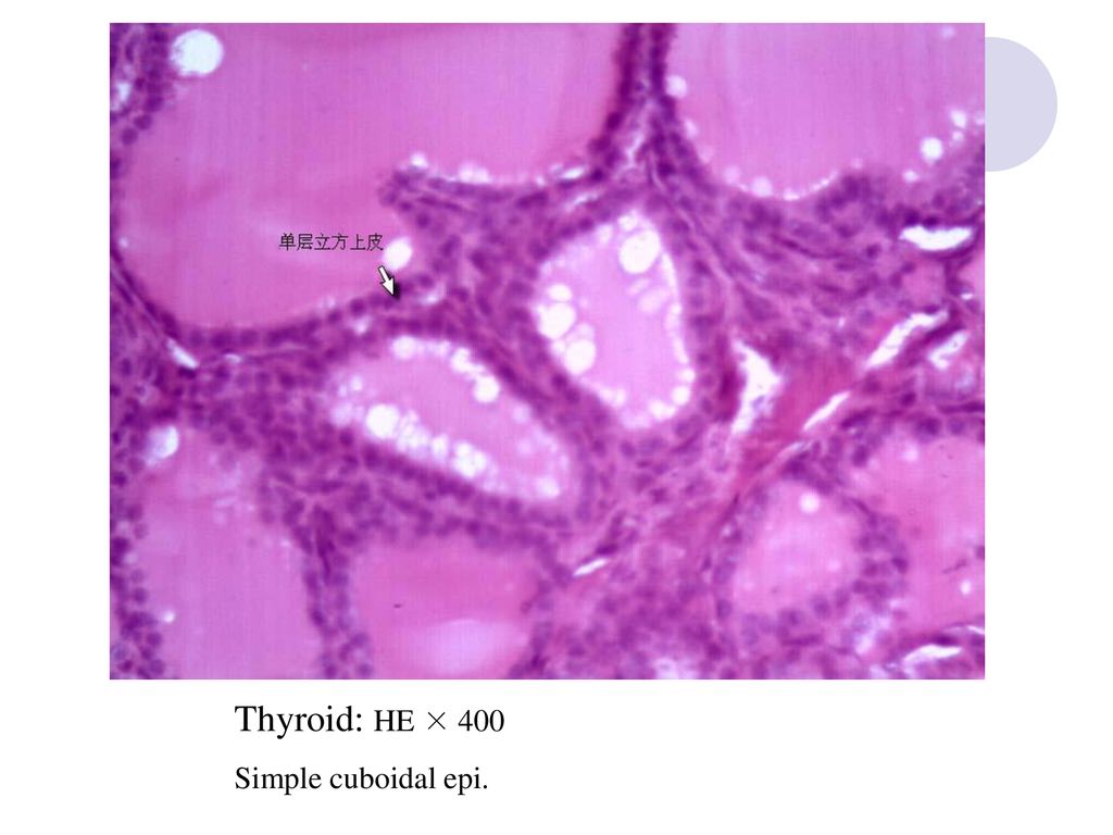 Thyroid: HE × 400 Simple cuboidal epi.