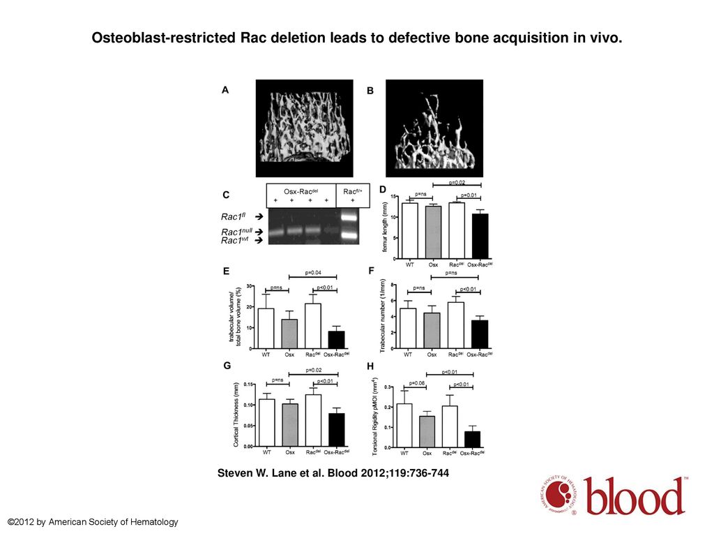 Osteoblast-restricted Rac deletion leads to defective bone acquisition in vivo.