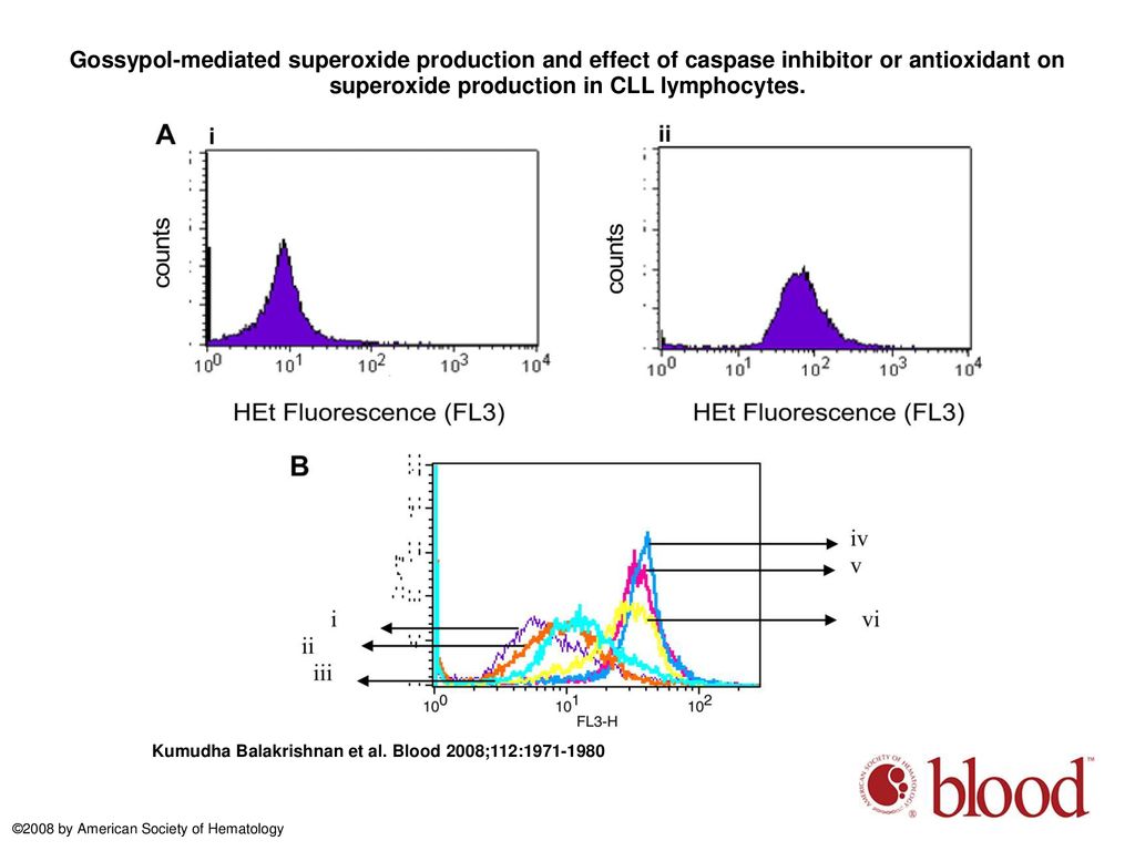 Gossypol-mediated superoxide production and effect of caspase inhibitor or antioxidant on superoxide production in CLL lymphocytes.