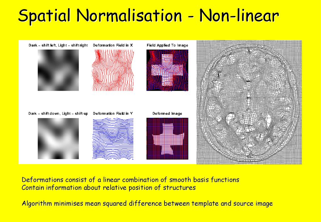 Computational neuroanatomy for dummies ppt download