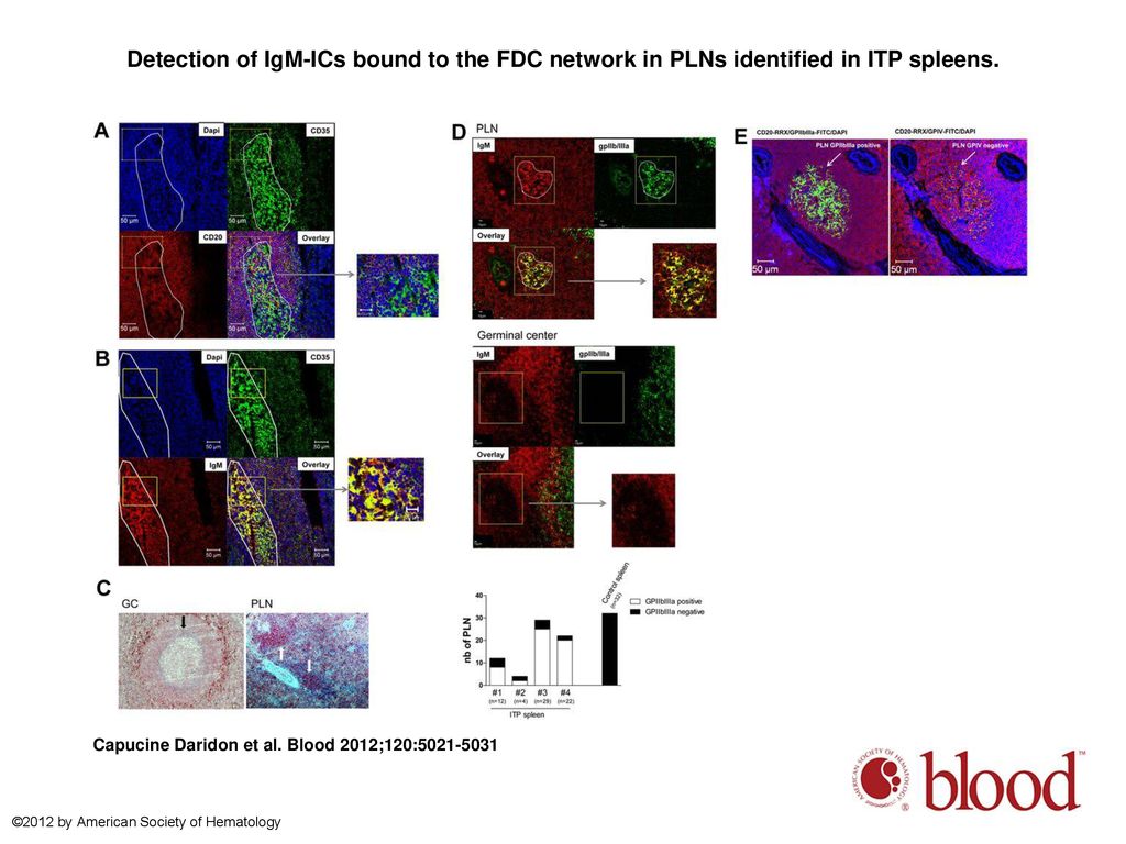 Detection of IgM-ICs bound to the FDC network in PLNs identified in ITP spleens.