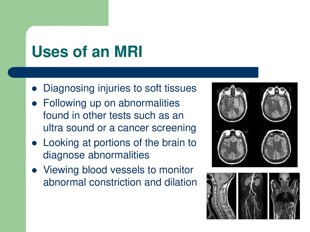 Magnetic Resonance Imaging - ppt download